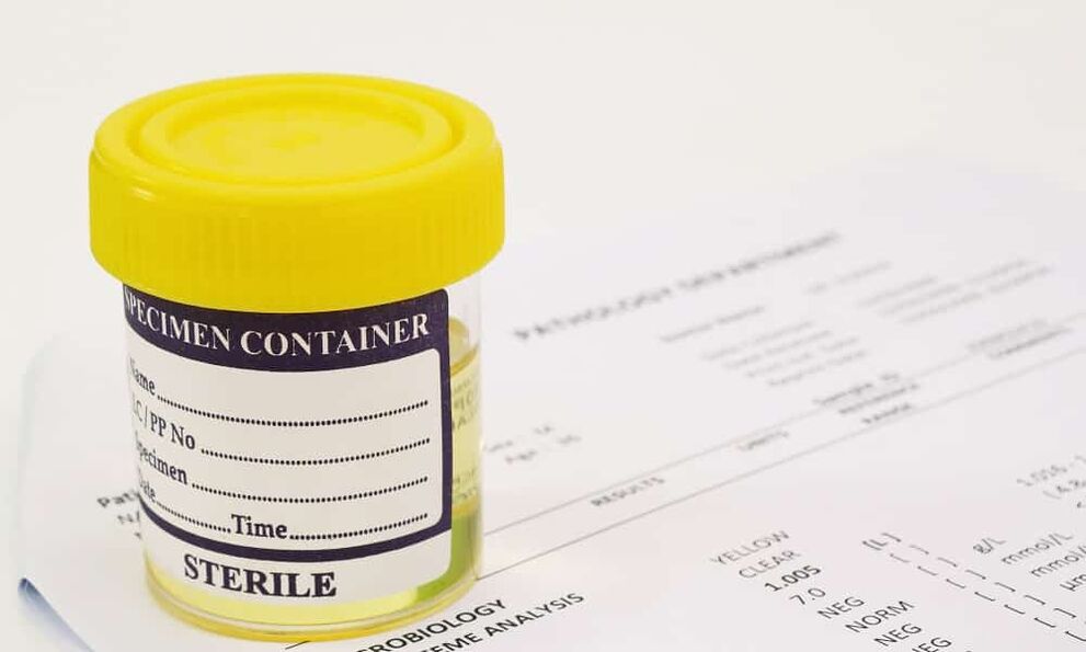 Πρέπει να κάνετε εξέταση ούρων πριν πάρετε αντιβιοτικά